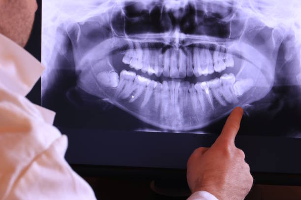 Best Emergency Dental Care for Broken or Chipped Teeth in Mount Hermon, VA