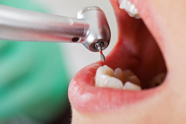 Best Urgent Care for Lost Fillings or Crowns in Mount Hermon, VA